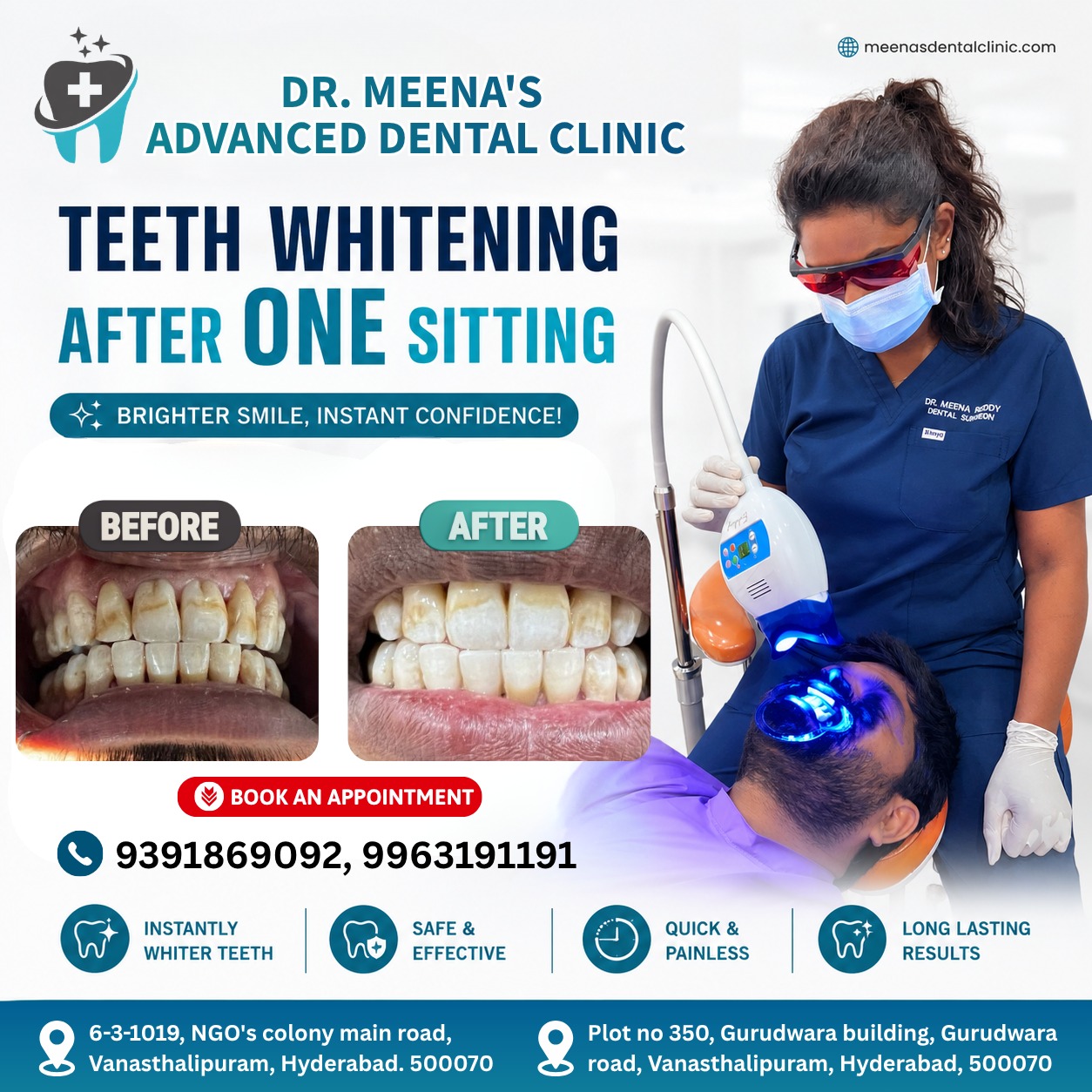 teeth-whitening-in-vanasthalipuram