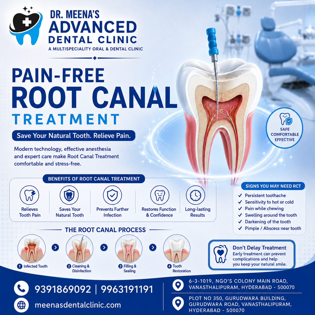 Top Reasons to Get a Root Canal in Vanasthalipuram