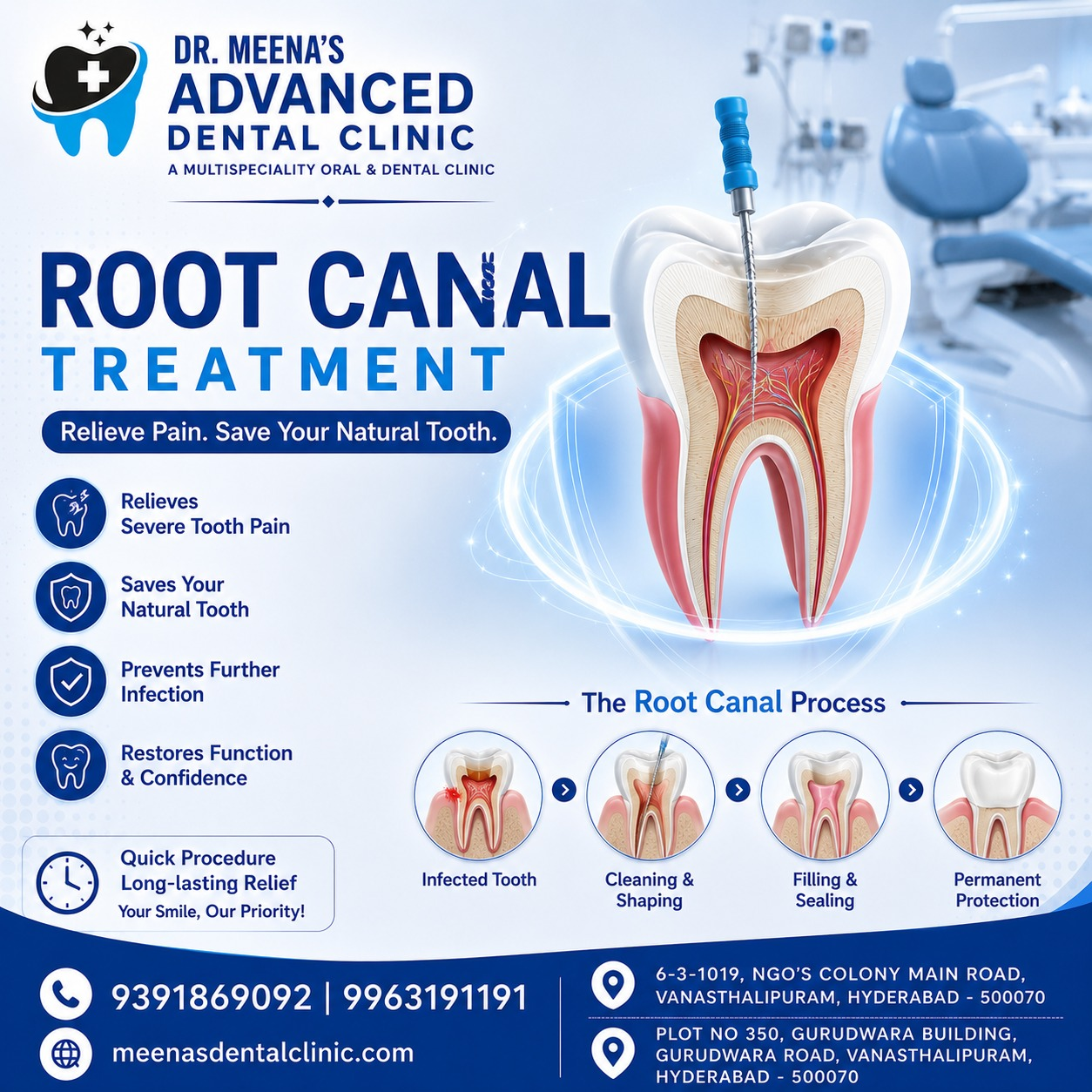 Painless RCT in Vanasthalipuram