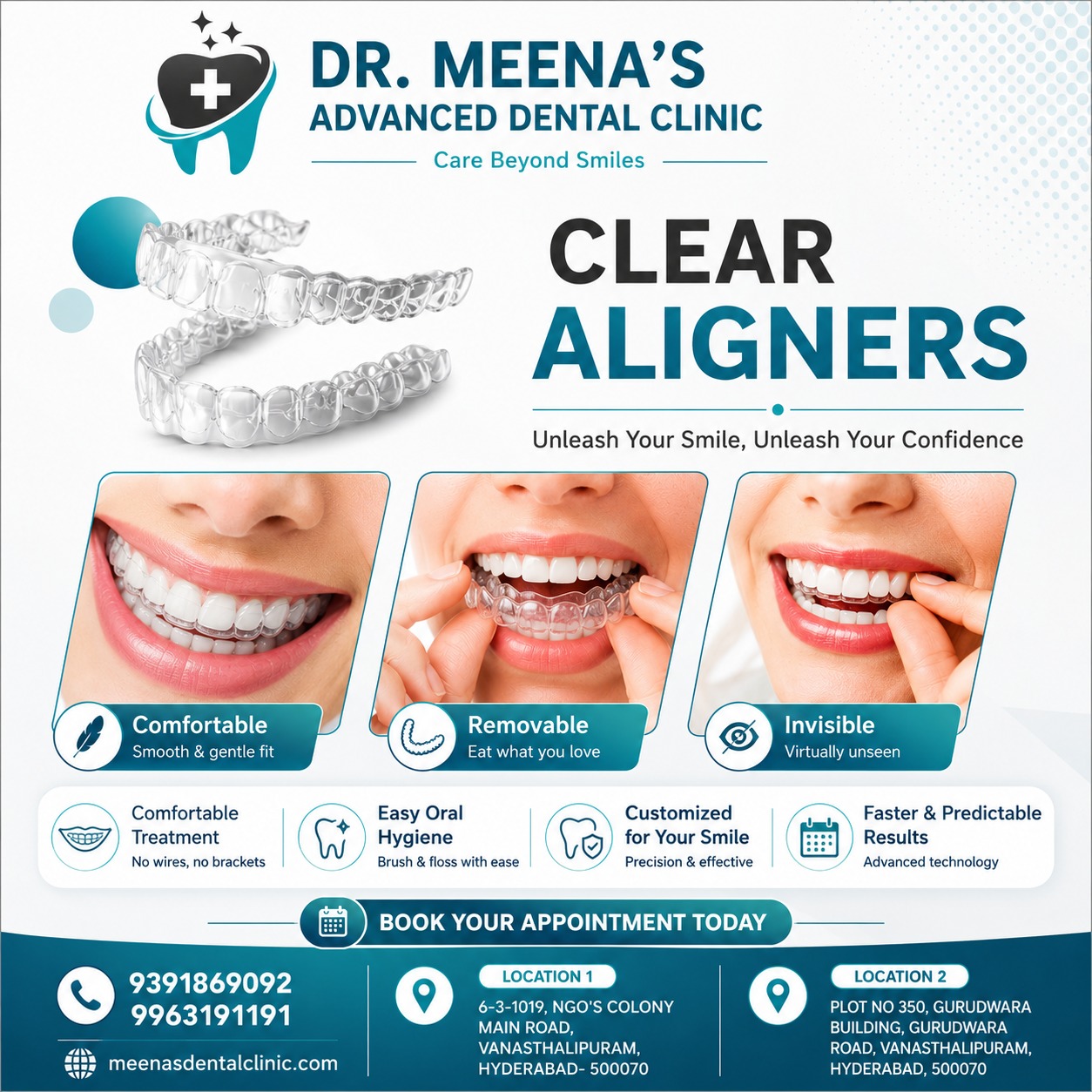 Invisalign Aligners Treatment in Vanasthalipuram