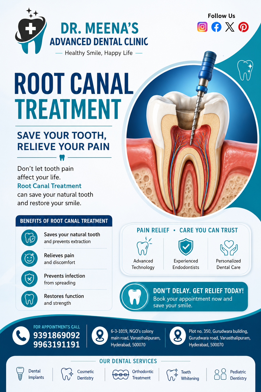 What Is a Root Canal and Its Cost and Treatment
